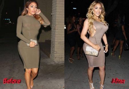 Nikki Mudarris Plastic Surgery: Before And After